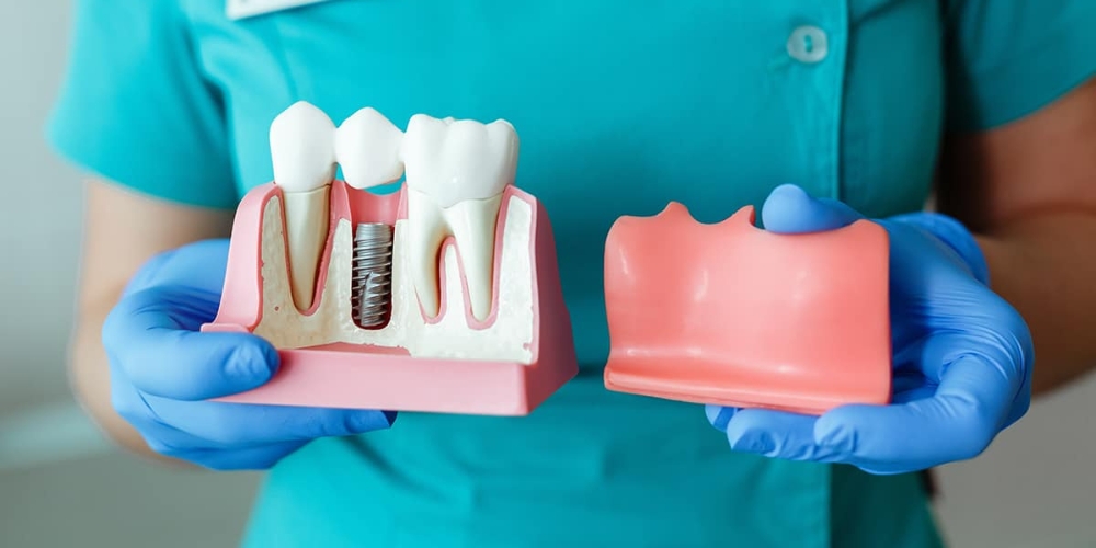 how do dental implants work