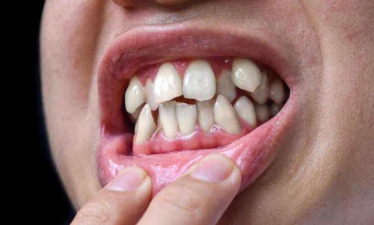 Cosmetic Dentist in Rifle